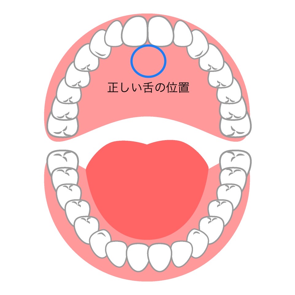 舌の正しい位置について